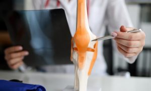 ​What Is Soft Tissue Injury in an Accident?