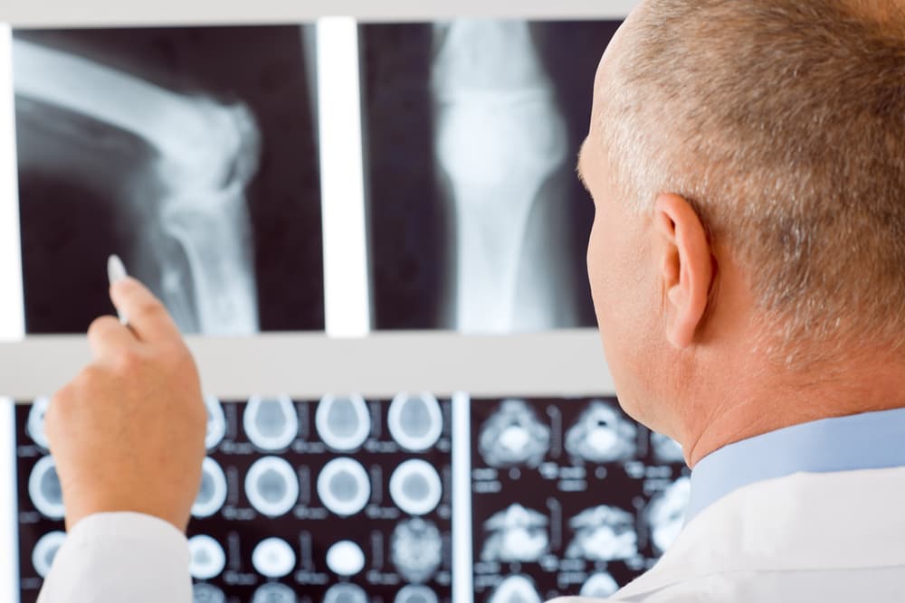 Experienced male senior doctor examining a set of X-rays for diagnosis and treatment planning.